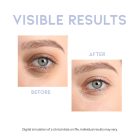 #OOTD Intensive Eye Serum - Intenzív szemkörnyékápoló szérum 30ml