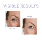 #OOTD Overnight Eye Cream - Szemránckrém a szarkalábak és szem alatti karikák csökkentésére 25g