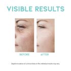 #OOTD Wrinkle Lift Retinol Serum - Ránctalanító retinol szérum 50ml